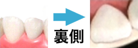 e.max / e.maxプレミアム