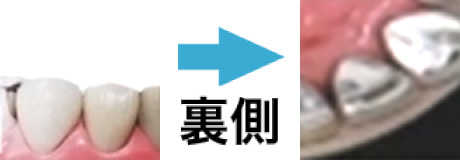 金属パラジウム合金